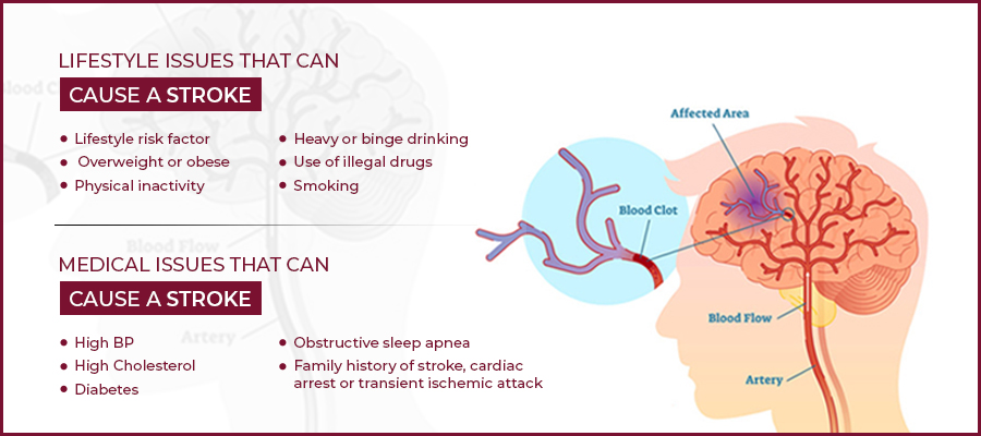 Post Stroke Care